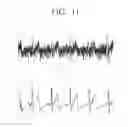 Fig. 12 - ELECTRONIC STETHOSCOPE APPARATUS, AUTOMATIC DIAGNOSTIC APPARATUS AND METHOD