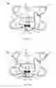 Fig. 06 - Designs and methods to facilitate swallowing of a tethered cell collection device