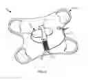 Fig. 07 - Designs and methods to facilitate swallowing of a tethered cell collection device