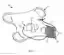 Fig. 08 - Designs and methods to facilitate swallowing of a tethered cell collection device