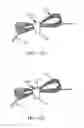 Fig. 16 - Designs and methods to facilitate swallowing of a tethered cell collection device