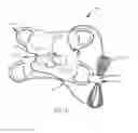 Fig. 18 - Designs and methods to facilitate swallowing of a tethered cell collection device
