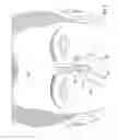 Fig. 04 - SEPTAL PERFORATION PROSTHESIS