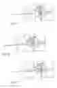 Fig. 09 - Methods, systems, and devices for the treatment of stenosis