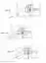 Fig. 12 - Methods, systems, and devices for the treatment of stenosis