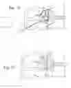 Fig. 14 - Methods, systems, and devices for the treatment of stenosis