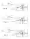 Fig. 18 - Methods, systems, and devices for the treatment of stenosis