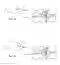 Fig. 19 - Methods, systems, and devices for the treatment of stenosis