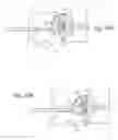 Fig. 25 - Methods, systems, and devices for the treatment of stenosis