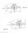 Fig. 26 - Methods, systems, and devices for the treatment of stenosis