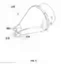 Fig. 05 - WOUND RETRACTOR