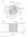 Fig. 04 - Anastomosis devices