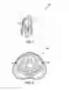 Fig. 02 - C-tourniquet