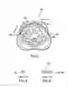 Fig. 03 - C-tourniquet
