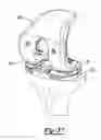 Fig. 19 - Bi-cruciate knee system