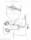 Fig. 02 - Kidney stone suction device