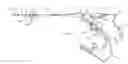 Fig. 01 - Lithotripsy apparatus using a flexible endoscope