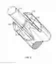Fig. 05 - Lithotripsy apparatus using a flexible endoscope