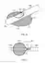 Fig. 04 - Surgical system with expandable shield