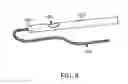 Fig. 05 - Surgical system with expandable shield