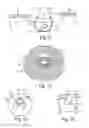 Fig. 05 - Single-pass endoscopic vessel harvesting