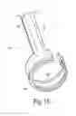 Fig. 07 - Single-pass endoscopic vessel harvesting