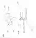 Fig. 04 - Methods and devices for laparoscopic surgery