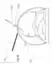 Fig. 22 - Methods and devices for laparoscopic surgery