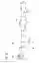 Fig. 14 - Catheter With Imaging Assembly With Placement Aid And Related Methods Therefor