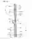 Fig. 17 - Catheter With Imaging Assembly With Placement Aid And Related Methods Therefor