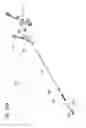 Fig. 35 - Catheter With Imaging Assembly With Placement Aid And Related Methods Therefor