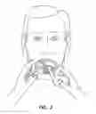 Fig. 04 - Natural orifice surgery system