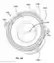 Fig. 07 - Natural orifice surgery system