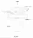 Fig. 11 - Natural orifice surgery system
