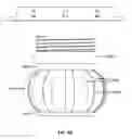 Fig. 13 - Natural orifice surgery system