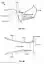 Fig. 18 - Natural orifice surgery system