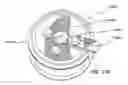 Fig. 37 - Natural orifice surgery system
