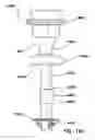 Fig. 40 - Natural orifice surgery system