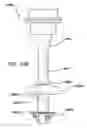 Fig. 41 - Natural orifice surgery system