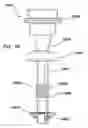 Fig. 42 - Natural orifice surgery system