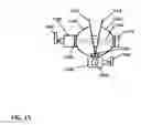 Fig. 14 - QUICK-RELEASE SYSTEMS FOR EXTRASKELETAL FIXATION