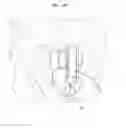 Fig. 16 - Devices and methods for monoaxial screw conversion