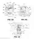 Fig. 06 - Interspinous vertebral stabilization devices
