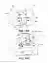 Fig. 11 - Interspinous vertebral stabilization devices