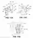 Fig. 14 - Interspinous vertebral stabilization devices