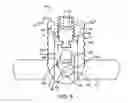 Fig. 10 - Interspinous spacer