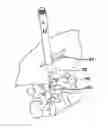 Fig. 01 - Methods and devices for spinal fixation element placement
