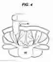 Fig. 06 - Methods and devices for spinal fixation element placement