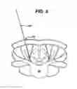 Fig. 07 - Methods and devices for spinal fixation element placement