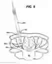 Fig. 08 - Methods and devices for spinal fixation element placement
